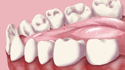 0c51d1395e3543ae-Coke_Teen_1203_un_03