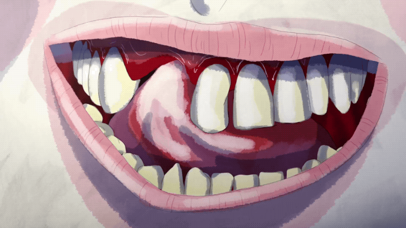16918_Px9b4U_teeth_03gif