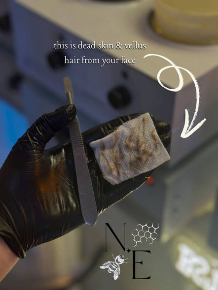 Dead skin and hair from face on tissue.