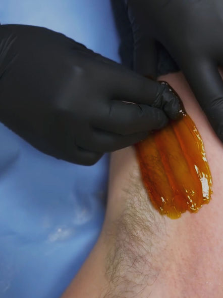 Applying wax to the body with black gloves for hair removal treatment.