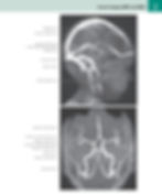Atlas Of Human Anatomy- Netter 7th Edition
