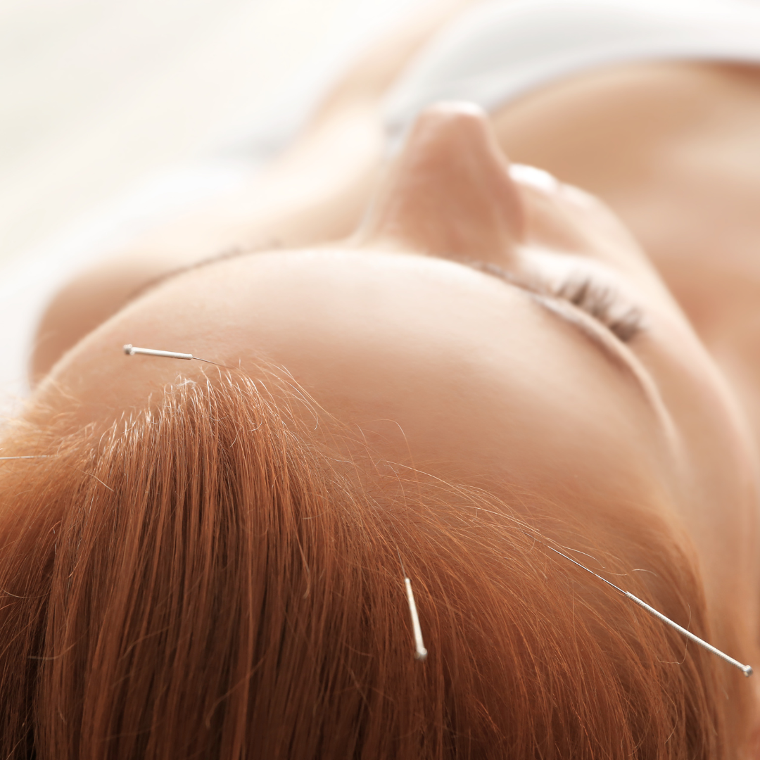 Five Element Acupuncture