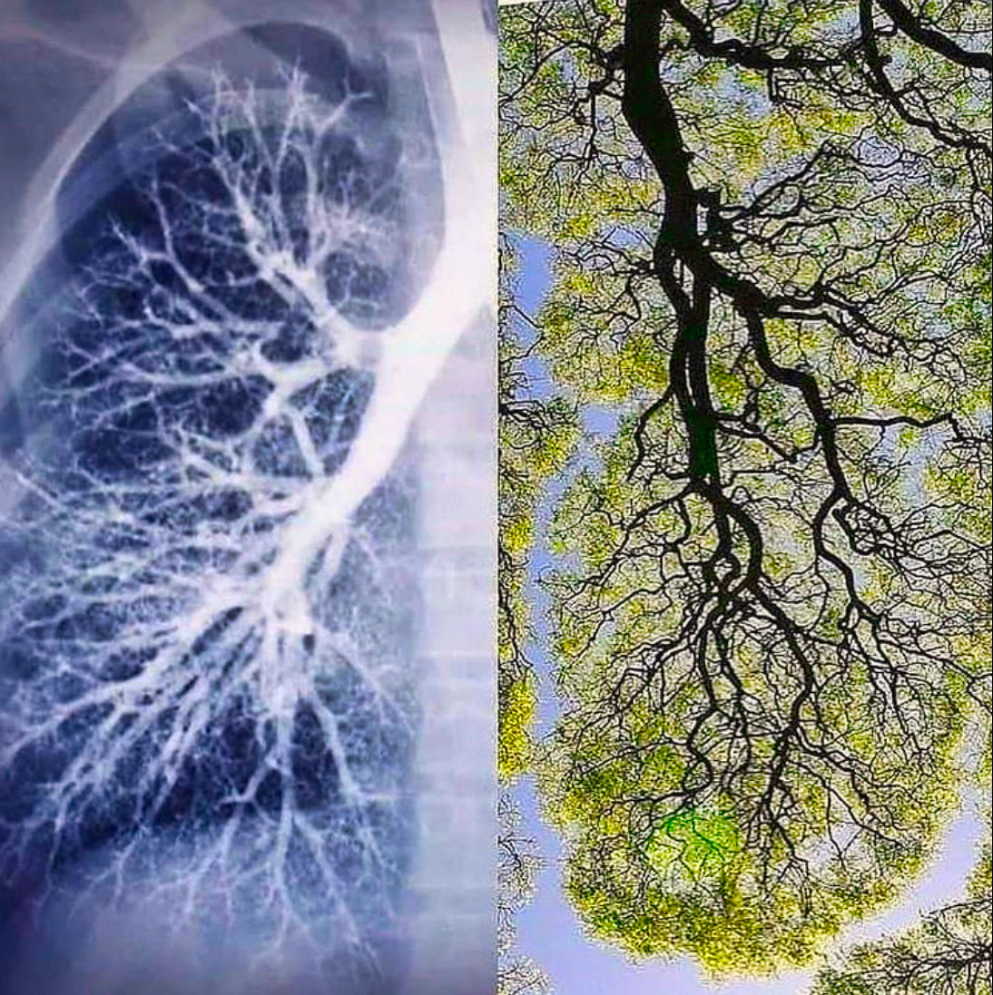 L'Arbre de Lumière en soi -  Soin global 1h30