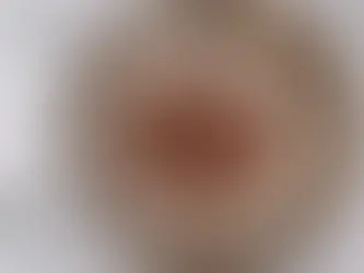 Tea Stains on Stainless Steel