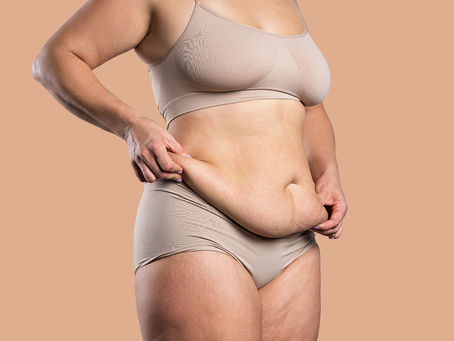 Why Women Store Fat Around the Abdomen