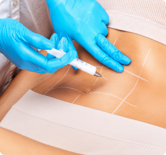 Non-surgical fat reduction at Timeless Beauty Med Spa