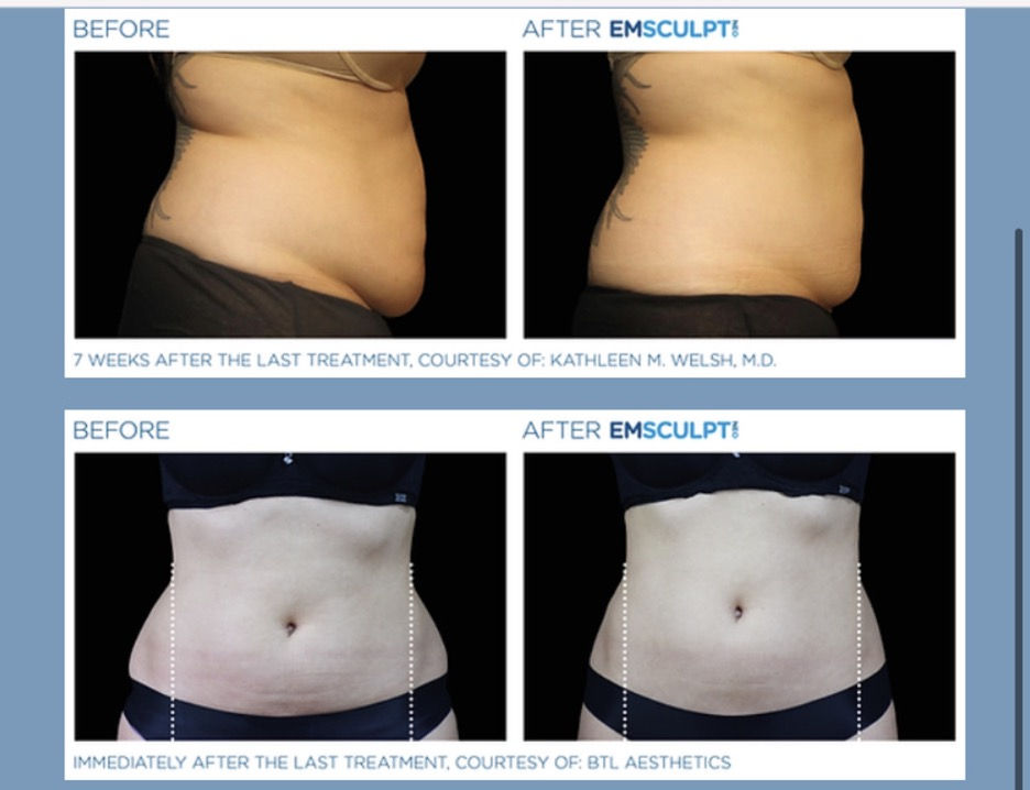 Aesthetic services showing final result
