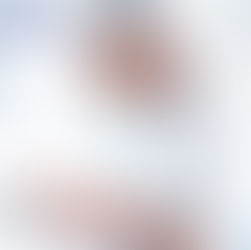 Lenti e filtri ad uso speciale ZEISS