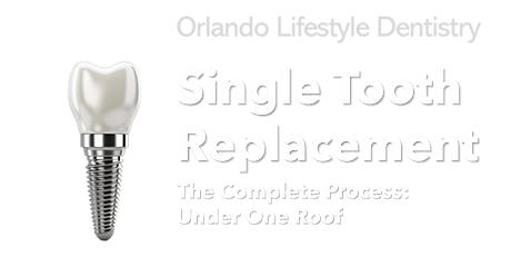 SINGLE TOOTH IMPLANT THE COMPLETE PROCESS UNDER ONE ROOF.png