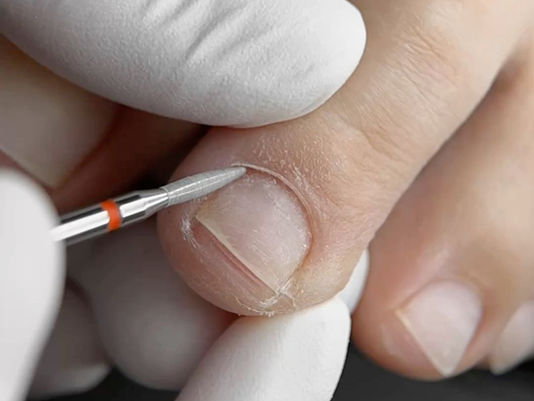 Intensivo de Pedicuría Combinada en Seco en CABA — Torno, Polygel y French en 1 Día