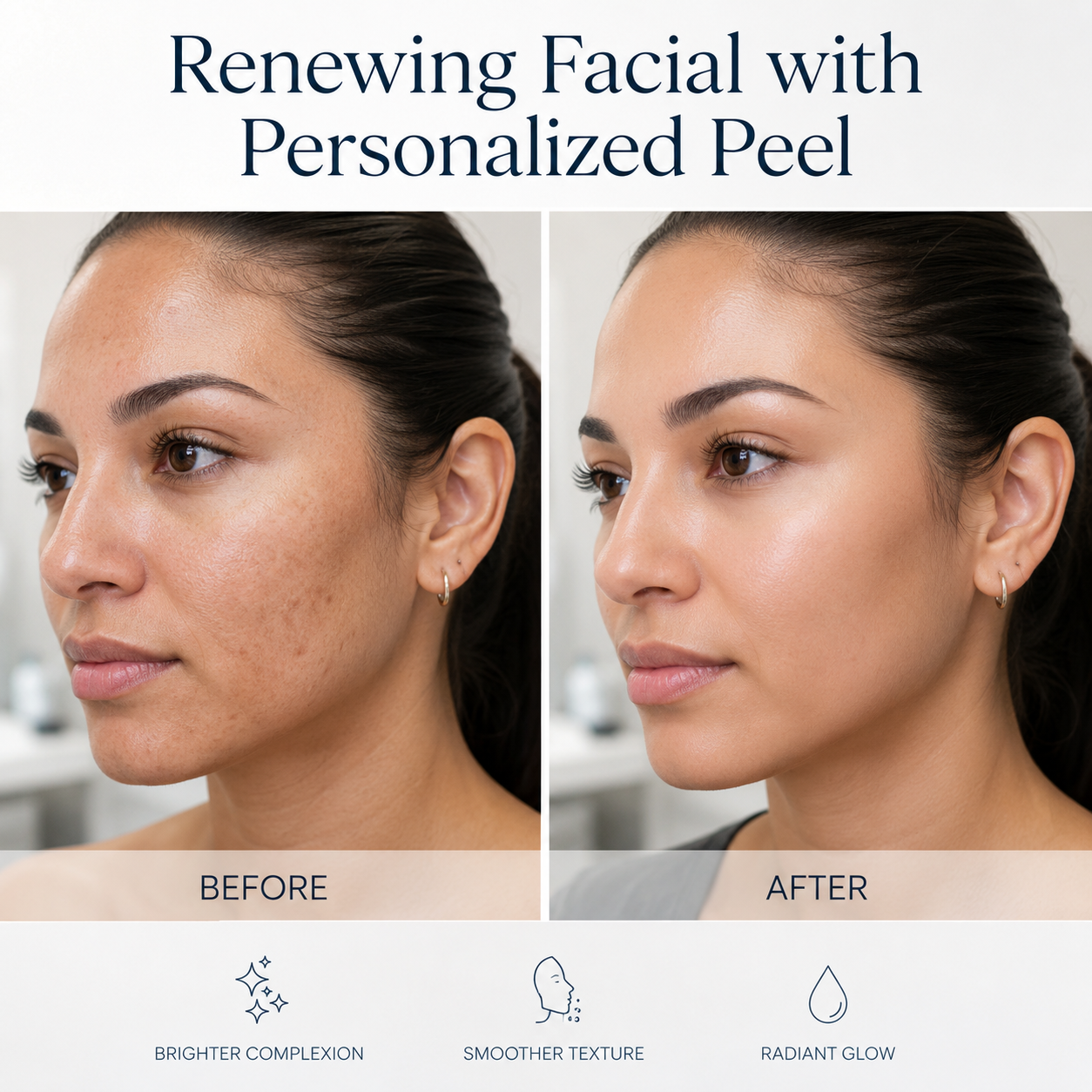 Before and after results of Renewing Facial with Personalized Peel at Browsome Studio Doral Miami