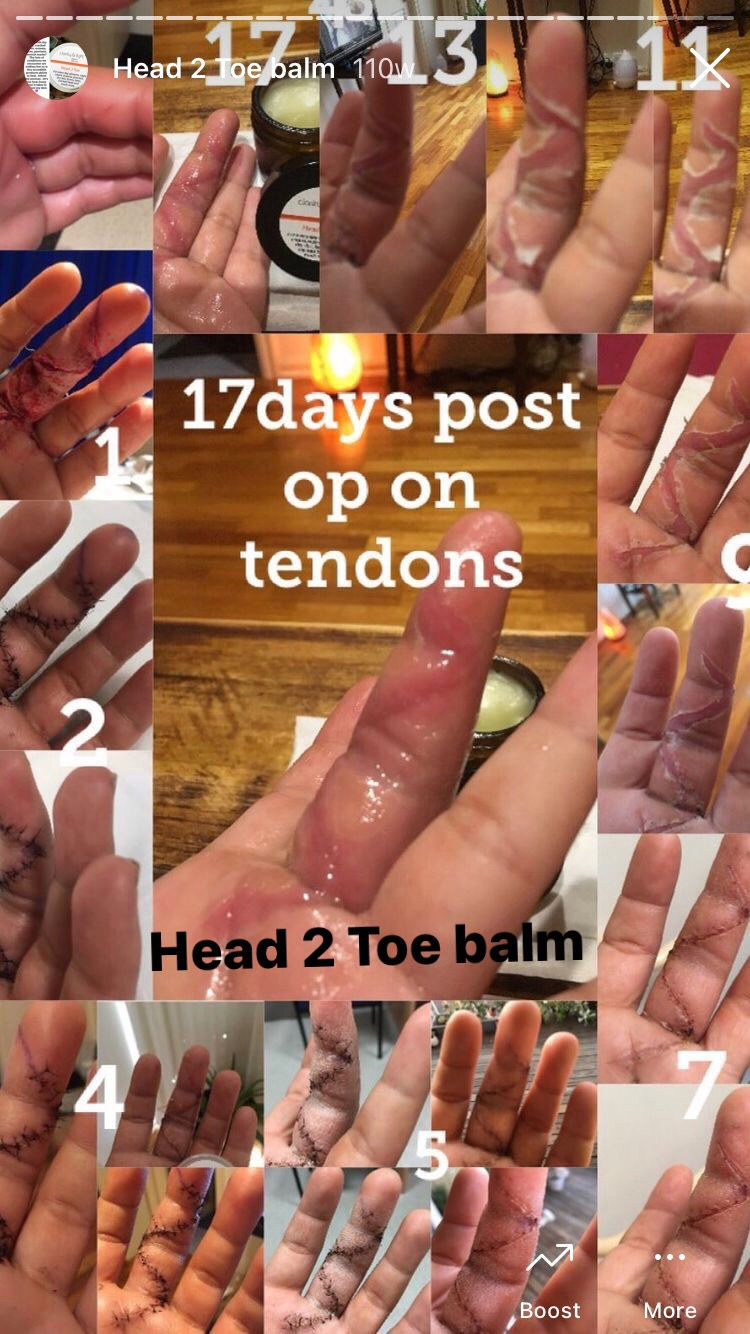 Thumbnail: HEAD 2 TOE BALM