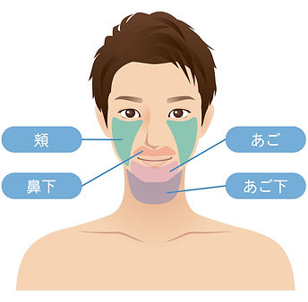 上田市男性のヒゲ脱毛