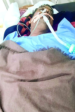  5 दिन में दूसरी बार जिंदा मरीज को बता दिया मृत, सांसें चलती रहीं 