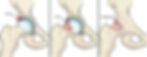 Anatomy of hip impingement