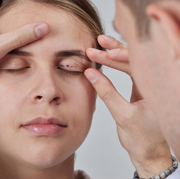 Upper eyelid blepharoplasty results