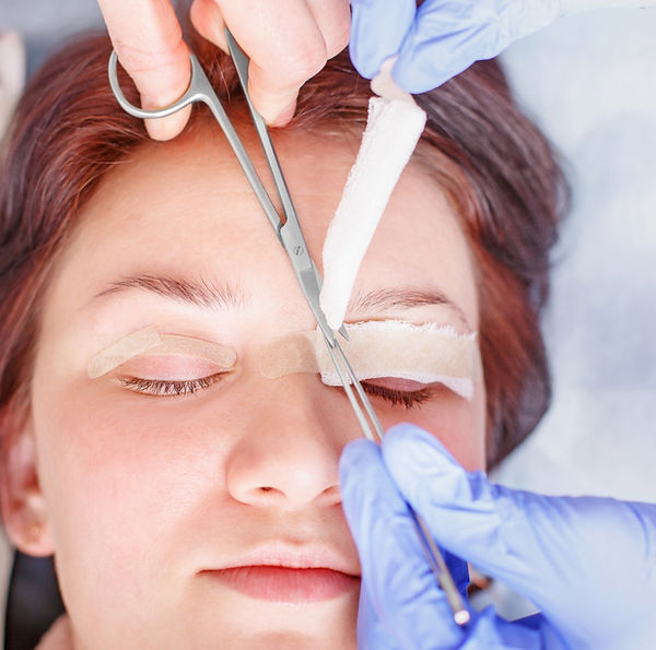 Upper eyelid blepharoplasty process