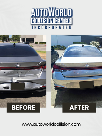 Hyundai Elantra Before and After.png