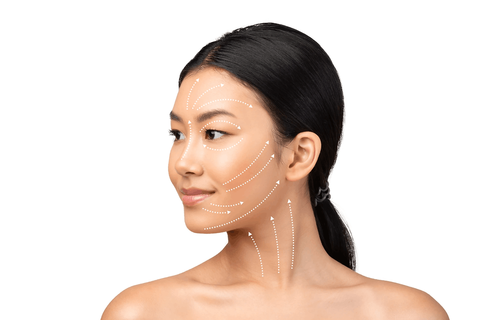 titanium lifting cheek