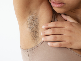 Dark Underarms Treatment in Malaysia: What Actually Works
