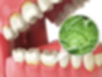Zen Dental Center in Capitol Hill, Seattle, WA 98102 Family Cosmetic Emergency Implants - Dental Checkup, Cleaning and Examinations, Crowns, Bridges, Implants, Restorations, Veneers, Tooth Extractions, Teeth Whitening, ClearCorrect, Dentures, Partial Dentures, Emergency Dentist, Invisalign Dentist, Kid Friendly Dentist, Periodontics, Root Canal Therapy