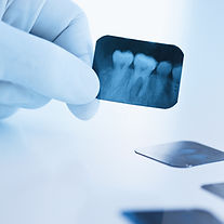 Dental%20x-ray_edited.jpg