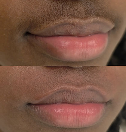north-florida-microblading-before-and-after-facial-sugaring.jpg
