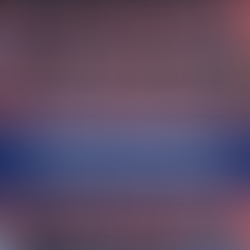 The Dementia You Can Prevent - photo of clogged arteries