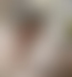 Jockeys, the best athletes in the world. So why are so many in hospital?