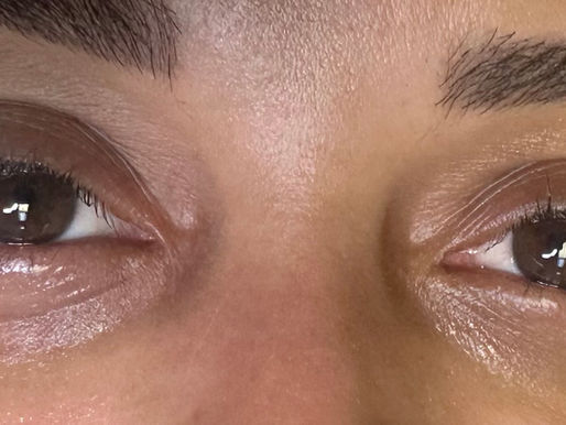 Say Goodbye to Dark Circles: Everything You Need to Know About Under Eye Camouflage Tattooing in St. Petersburg, F