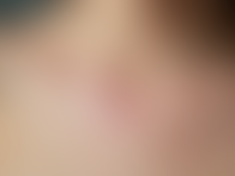 Innovative Scar Camouflage Techniques in Focus: Latest Scar Coverage Methods