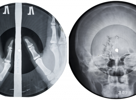 Fottere l’autorità per amore della musica: “X ray audio”, stampe pirata su radiografie scartate ("bone music, la musica delle ossa").