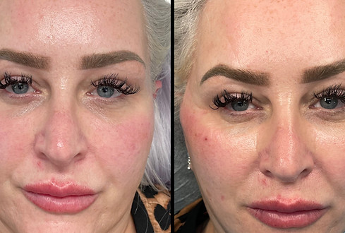 before and after aesthetics