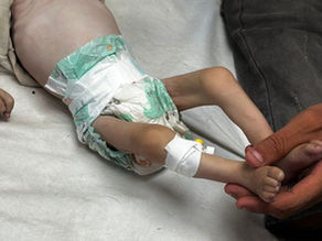 "No Starvation in Gaza"? Facts and Figures