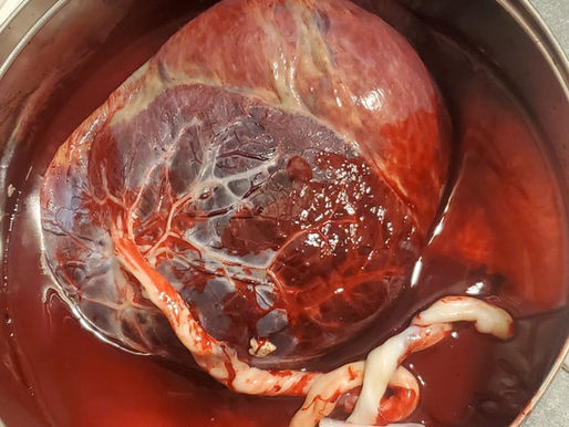 The Amazing Placenta