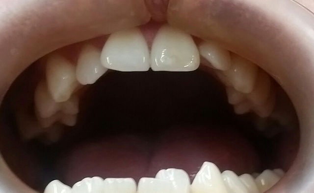 Fotografía oclusal superior Dental Unlimited