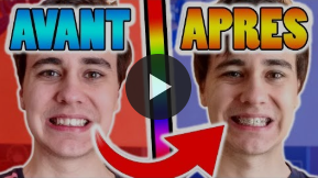 « Comment survivre à l’appareil dentaire ? » un Youtubeur répond aux questions des jeunes