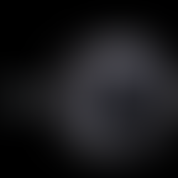 Il a vécu 24 ans avec une dent de requin dans le pied…