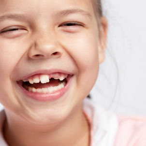 Le cours de la dent de lait a baissé entre 2023 et 2024