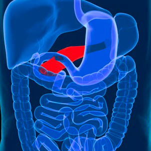 Un autre cancer favorisé par une mauvaise hygiène dentaire : celui du Pancréas