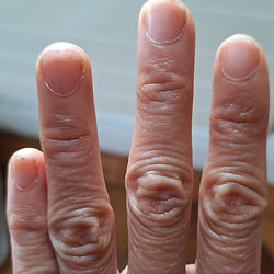 Hand von vorne mit sichtbaren Fingernägeln, deutlich für Online-Handlesen