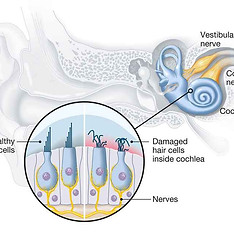 damaged-hair-cells.jpg