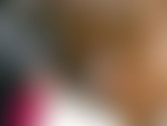 Uncovering the Truth: Myths and Misconceptions Surrounding Cochlear Implants