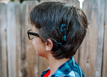 Cochlear_web.jpg