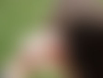 कॉक्लियर इम्प्लांट कैसे काम करता है? 🎧