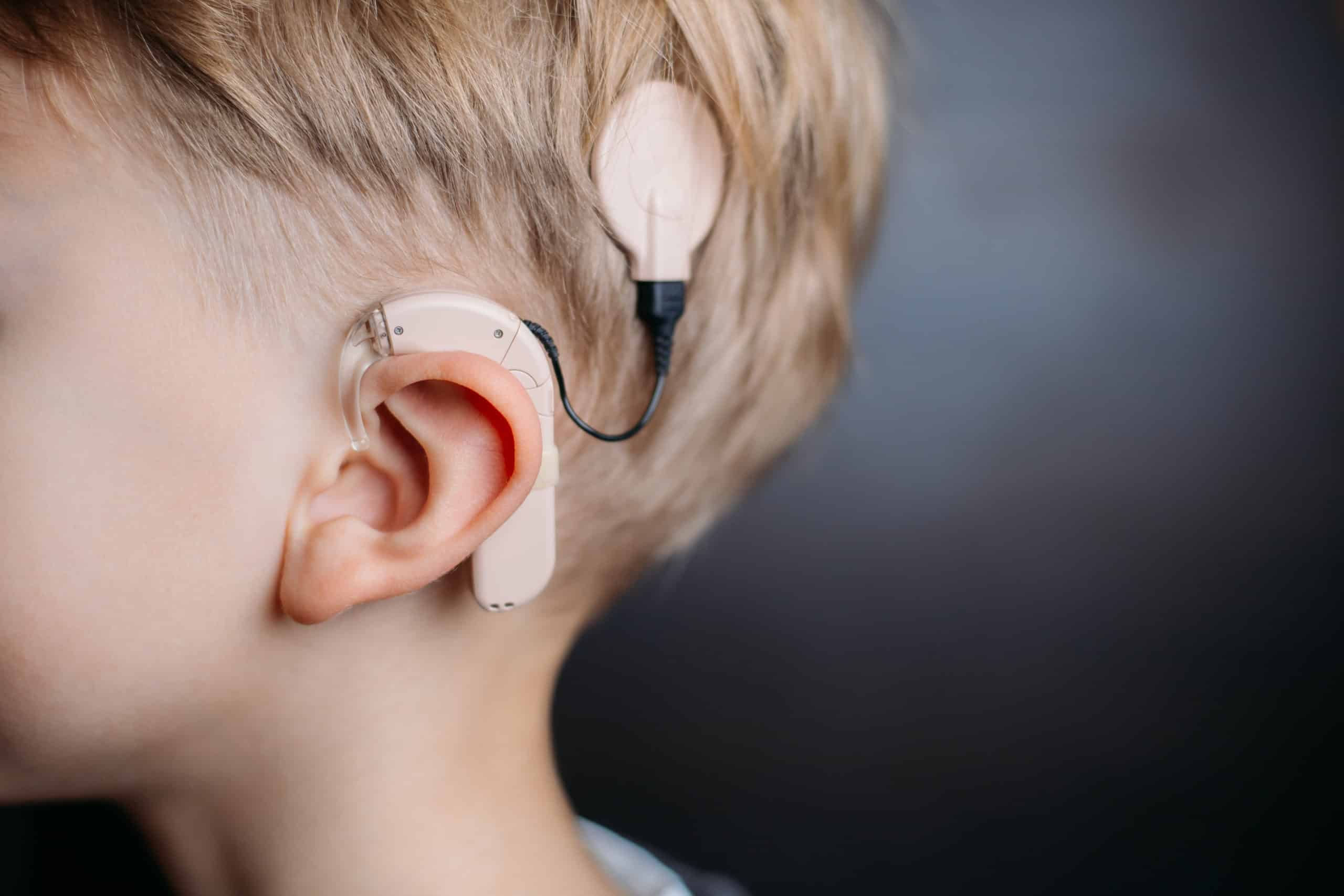 a boy wearing beige color cochlear implant processor