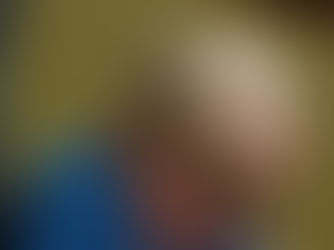 Sleeping baby with a cochlear implant, head bowed in a blue shirt against a blurred warm background.