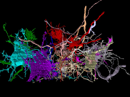 Mapping the Human Brain: Opening New Paths for Treating Alzheimer’s and Autism