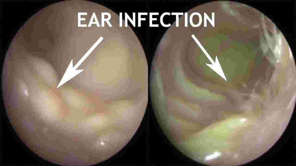 Ear Problems in Astrology