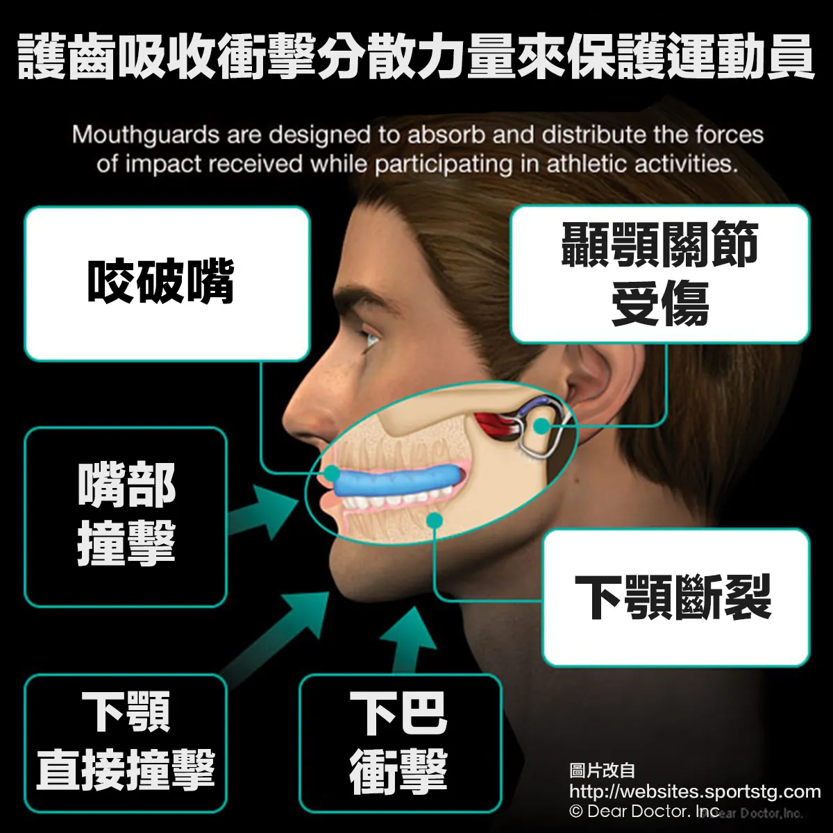 Taiwan Taipei Neihu Dazhi Tianmu Shilin Xinyi Longwood Dental Dentist Custom Fitted Sports Mouthguard Mouthpiece 台北內湖大直長木牙醫運動護齒器護牙套護齒牙托 #預防牙醫 #長木牙醫 #大直牙醫推薦 #內湖牙醫推薦 #台北牙醫推薦 #taiwan #taipei #dentist #mouthguard #mouthpiece #sportsmouthguard #運動護齒推薦 #運動護齒托推薦 #運動護齒套推薦 #運動護牙套推薦 #運動護牙托推薦 #運動牙套推薦 #護齒推薦 #護齒套推薦 #牙套推薦 #護齒器推薦 #拳擊 #武術 #mma #重訓 #重量訓練 #跆拳道 #空手道 #柔道摔角角力 #橄欖球 #美式足球 #足球 #籃球 #棒球 #曲棍球 #壘球 #排球 #水球 #體操 #滑冰溜冰 #直排輪 #重型機車 #單車腳踏車 #馬術 #滑雪 #滑板#攀岩溯溪 #跳傘 #衝浪 #舉重 #CrossFit #賽車 #激烈操駕 #極限運動